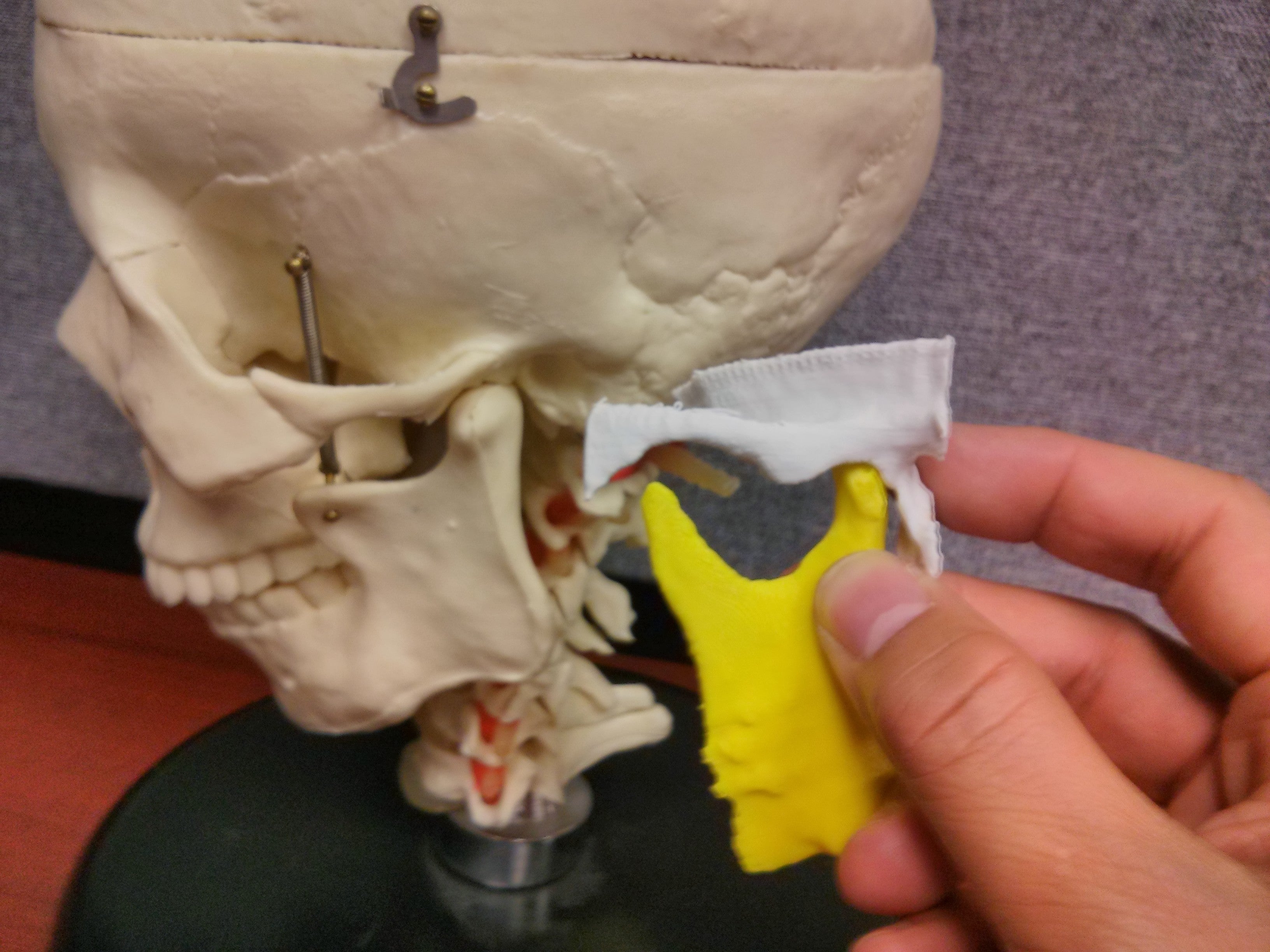 3D Printed models of the mandible and temporal bones
