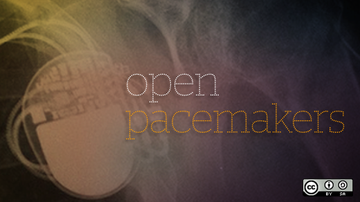 Open pacemakers